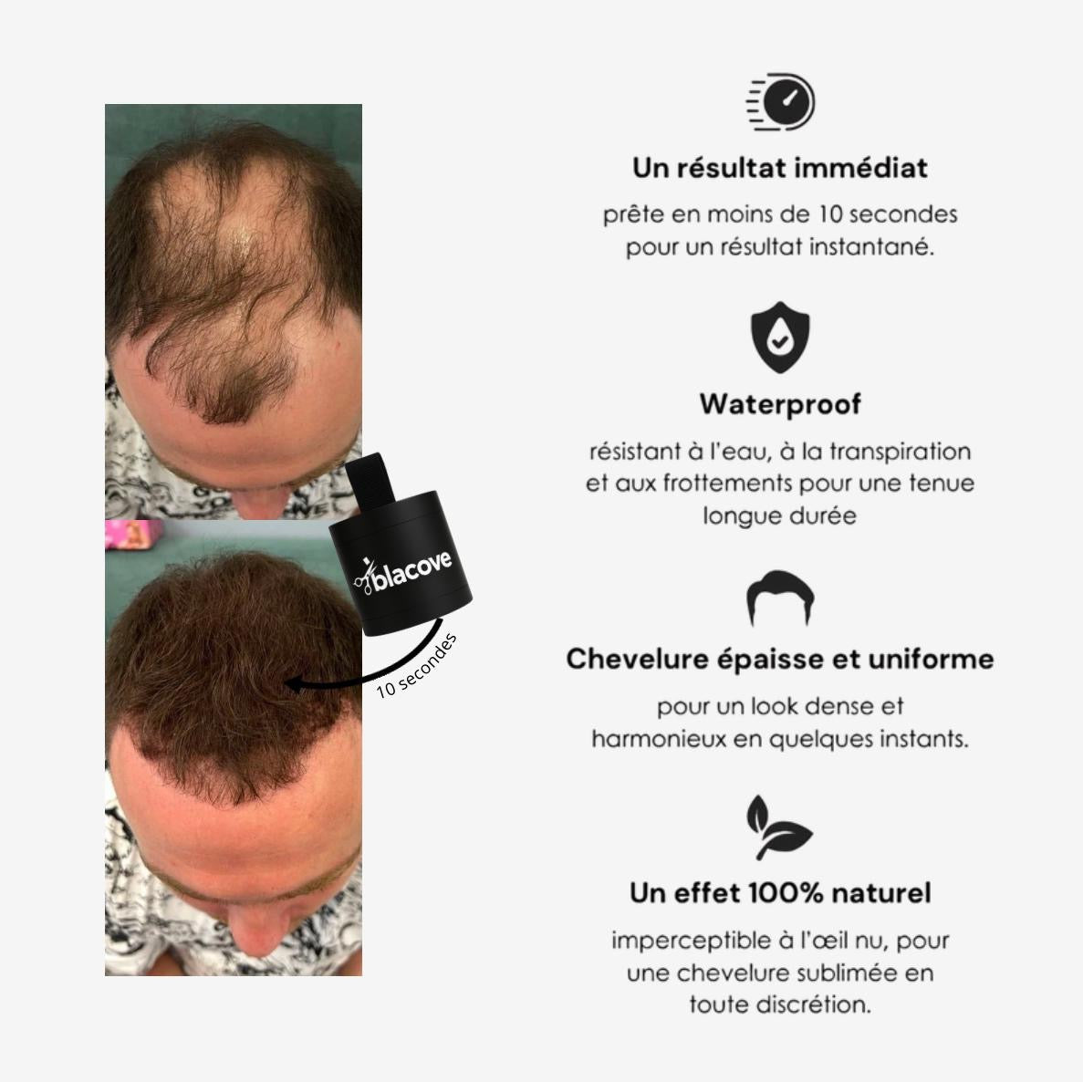 Camouflage Capillaire – Homme